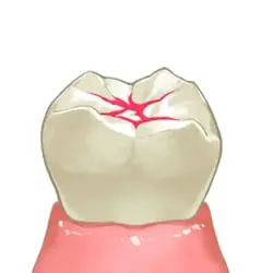 イメージ:シーラント塗布
