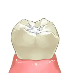 イメージ:固まったら完了
