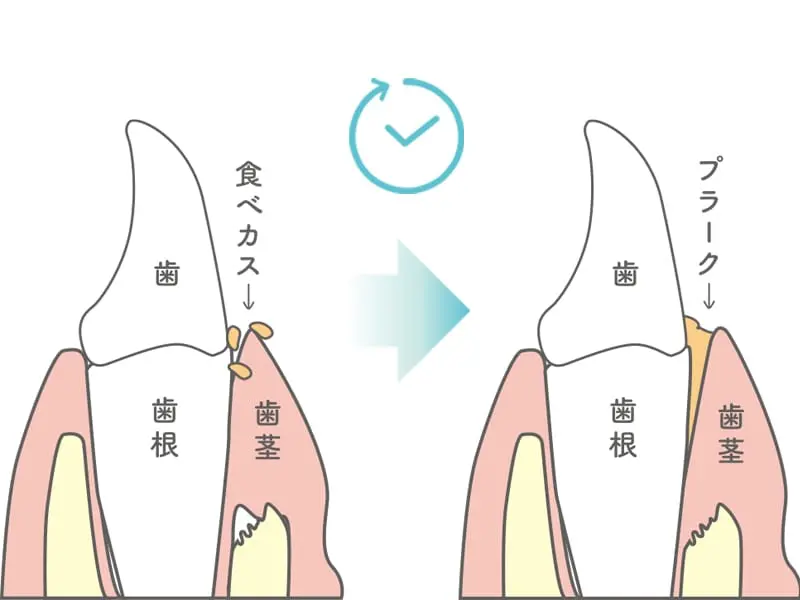イメージ:食後の食べカスや汚れは、約8時間でプラーク（歯垢）ができるといわれています。